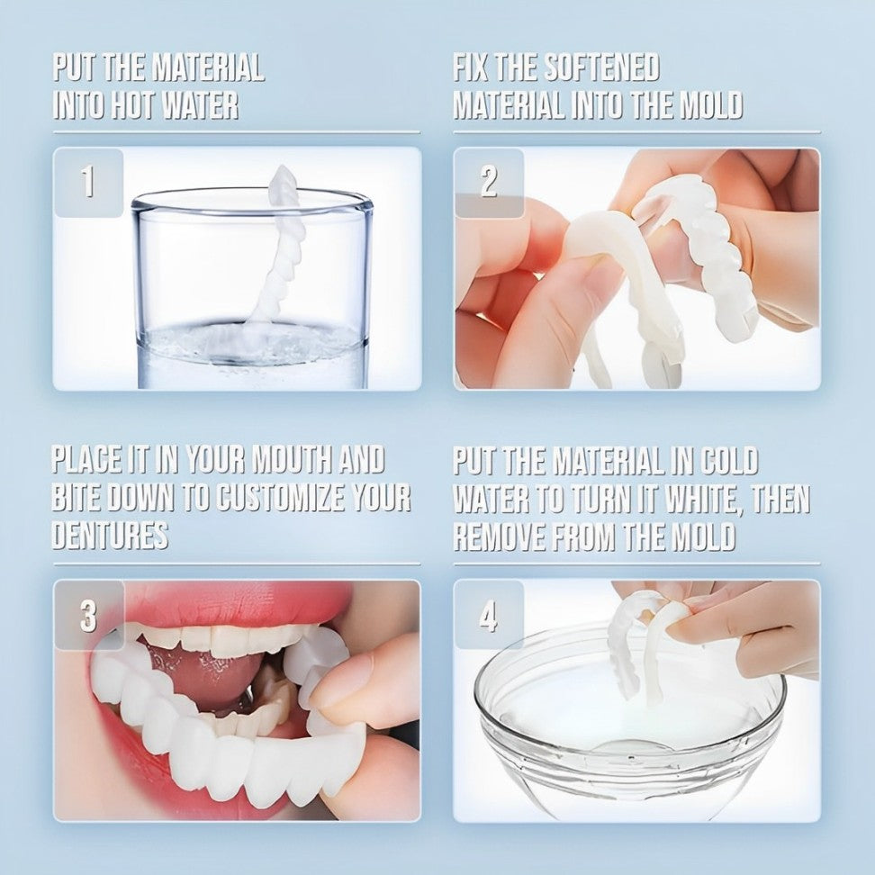 Faccette dentali (superiori e inferiori incluse)