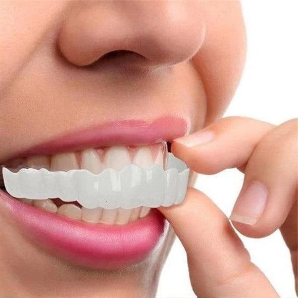 Faccette dentali (superiori e inferiori incluse)