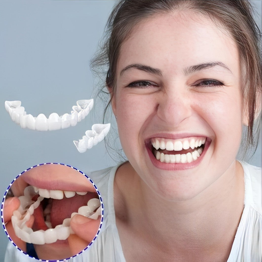 Faccette dentali (superiori e inferiori incluse)