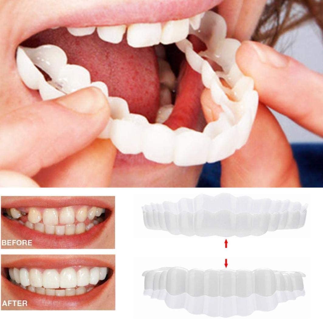 Faccette dentali (superiori e inferiori incluse)